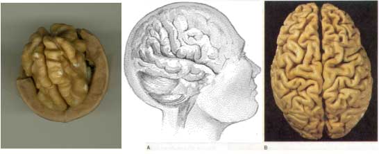 An illustration comparing a walnut and a human brain.